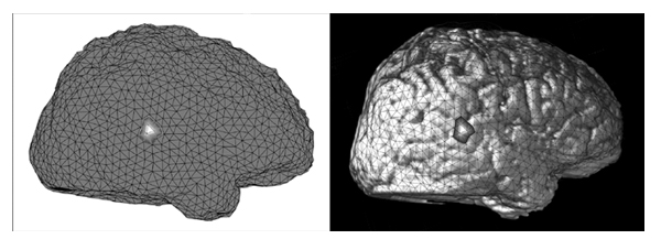 $B%a%C%7%e%b%G%k$K$h$k(JMCE$B2hA|$H(JMRI$B;0<!85:F9=@.2hA|$N9g@.(J