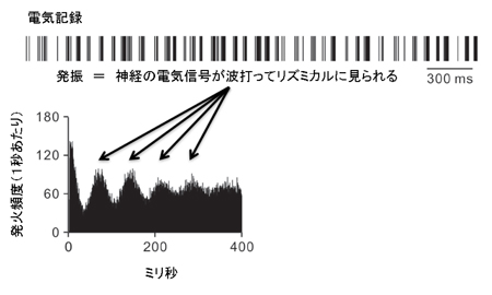 パーキンソン２.jpg