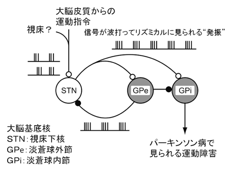 パーキンソン４.jpg