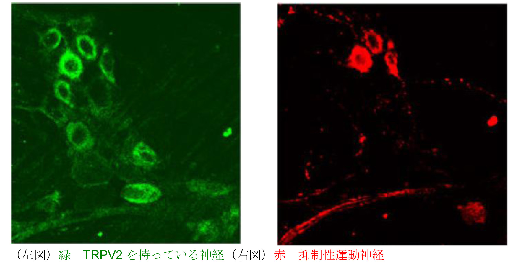 図1TRPV2.jpg