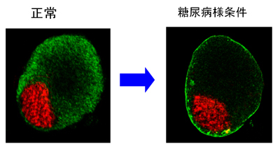 糖尿病３.jpg