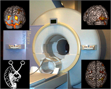 Magnetic Resonance Imaging System