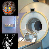 Magnetic Resonance Imaging System