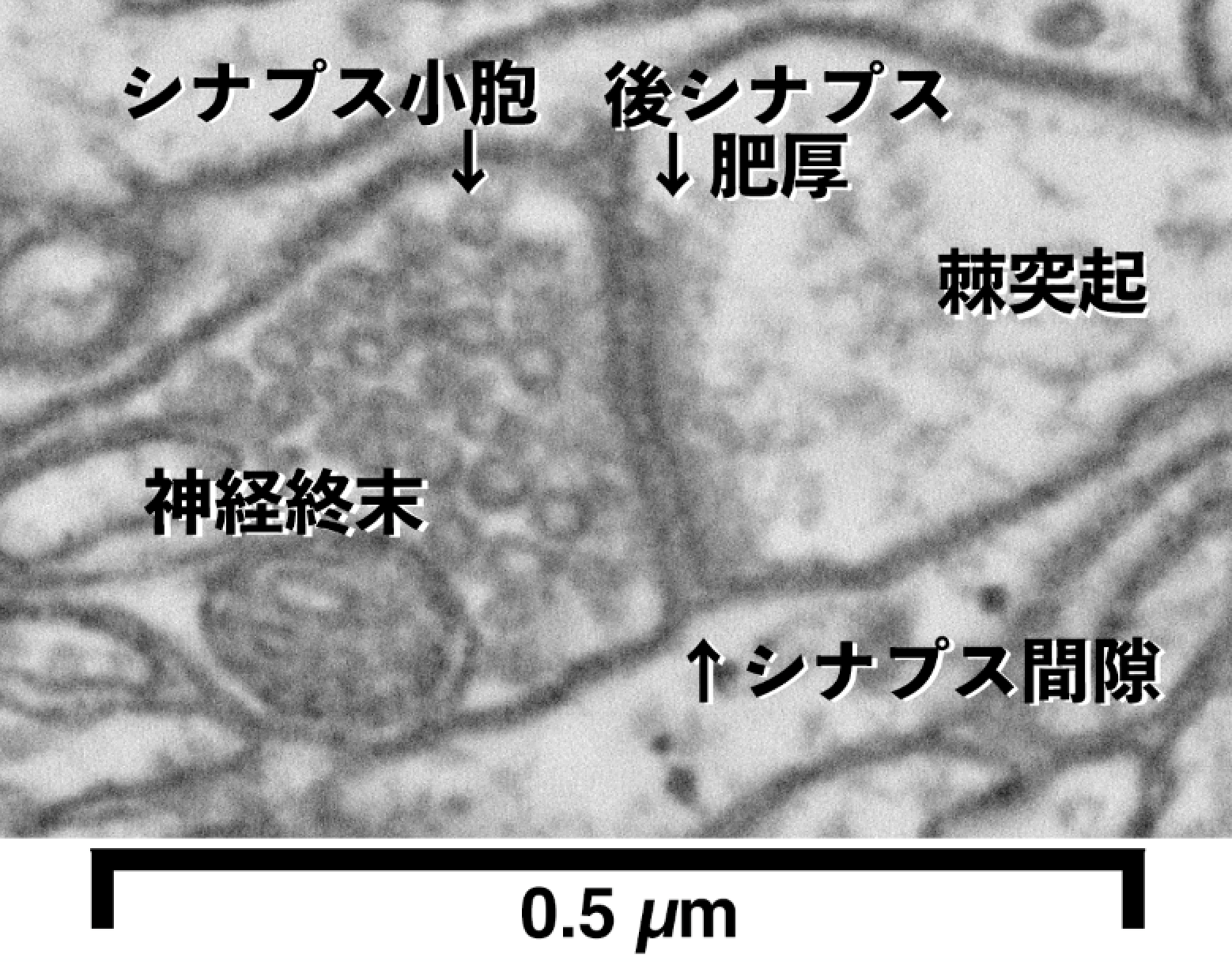 カーボンナノチューブで電子顕微鏡神経回路観察法に革命!