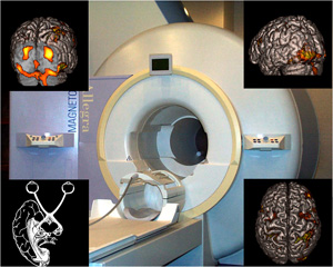 磁気共鳴断層画像装置（MRI: 3 tesla）
