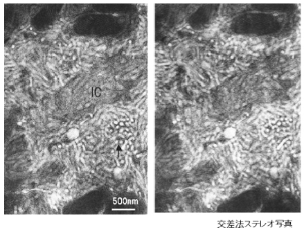 図1．壁細胞の交差法ステレオ写真（±8度