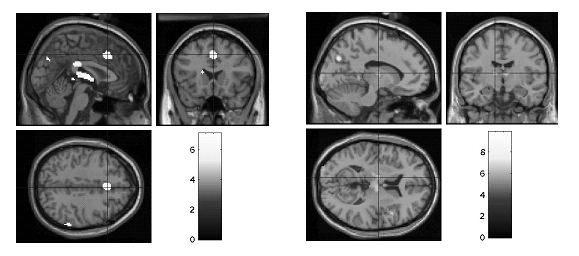 図：fMRI断層画像を解析して得られた脳断面図の例。