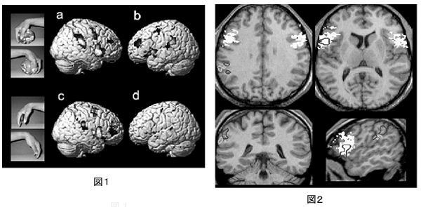 Figure1