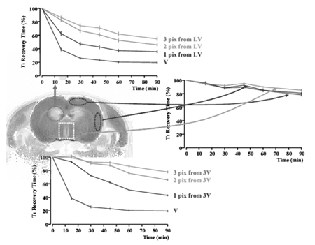 図1.　MnCl2静脈内投与によるT1緩和時間の変化。
