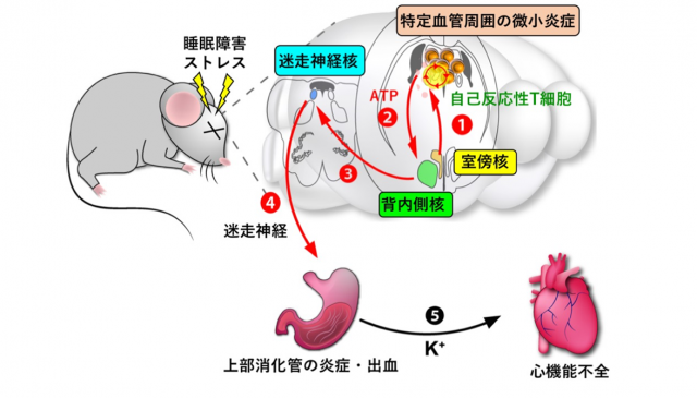 病は気から： ストレスによる病気の治療薬とバイオマーカーの開発