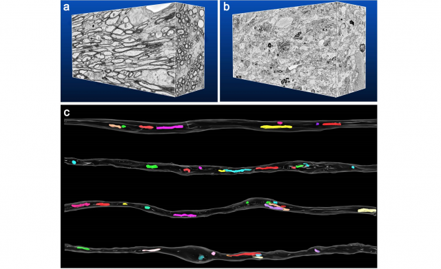 高速連続電子顕微鏡画像取得による生物組織の3次元微細構造解析