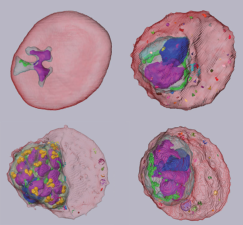2-image-Sakaguchi_et_al-malaria parasite_infected_RBC.jpg