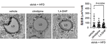 ミトコンドリアの品質を維持する薬が糖尿病や脂肪肝を改善させる～生活習慣病の改善を指向したエコファーマ創薬に期待～