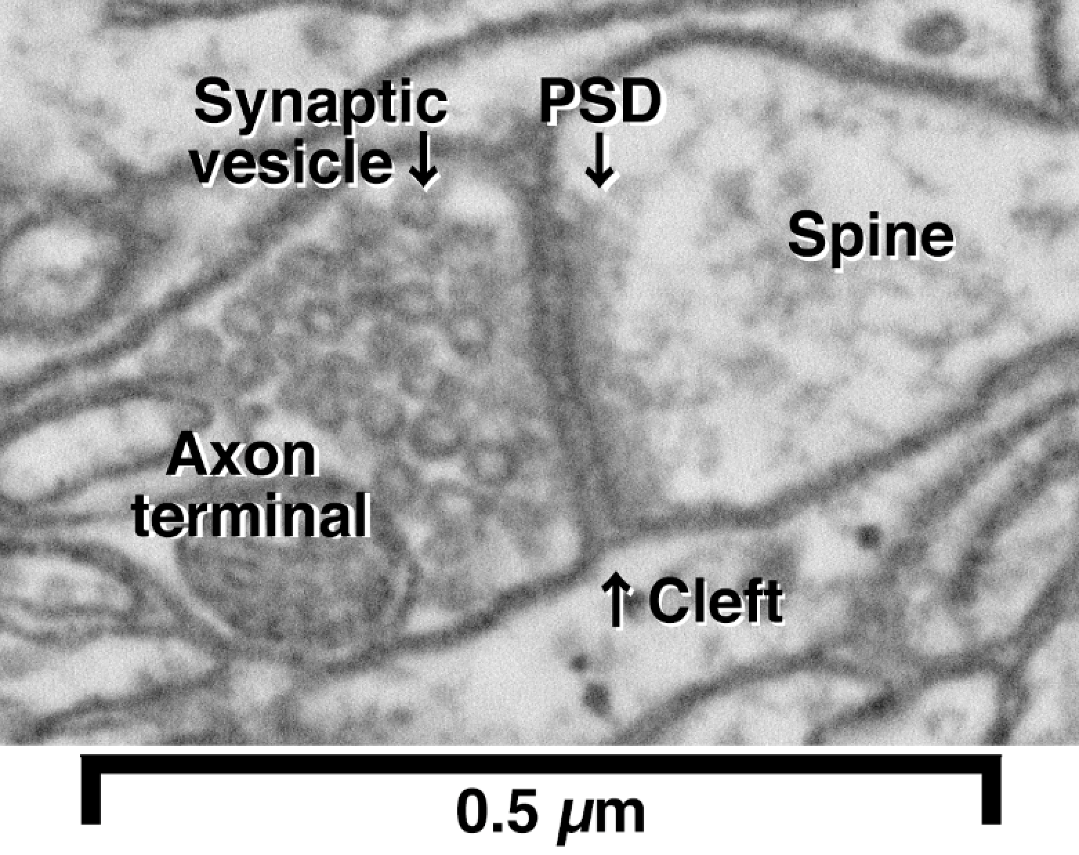 A high magnification image of synapse obtained by electron microscopy