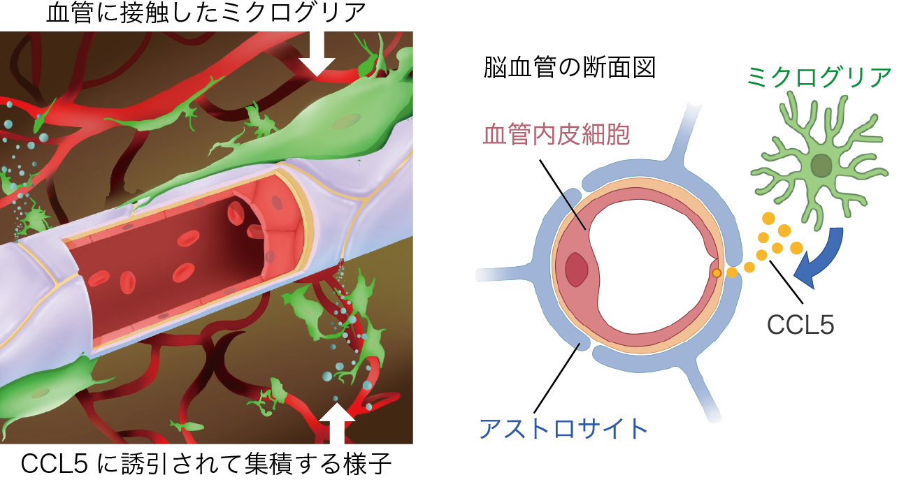 精神・神経変性疾患の治療に朗報～脳内免疫細胞ミクログリアが血液脳関門の機能を制御することを発見