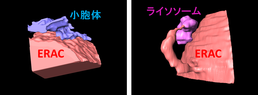 小胞体内における異常タンパクの新たな処理メカニズムを発見!