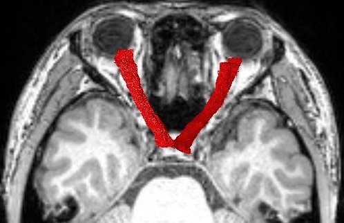 Takemura et al. (2023) Magn Res Img