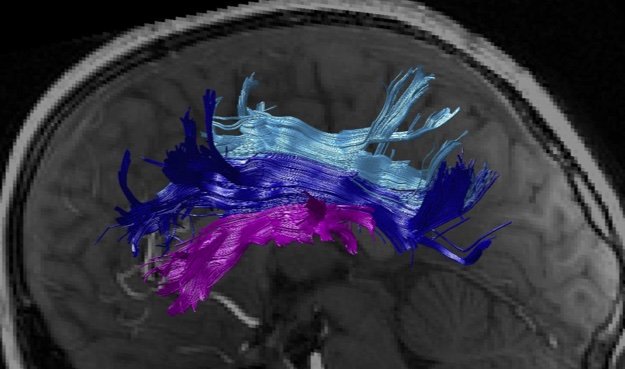 Amemiya et al. Cortex 2021