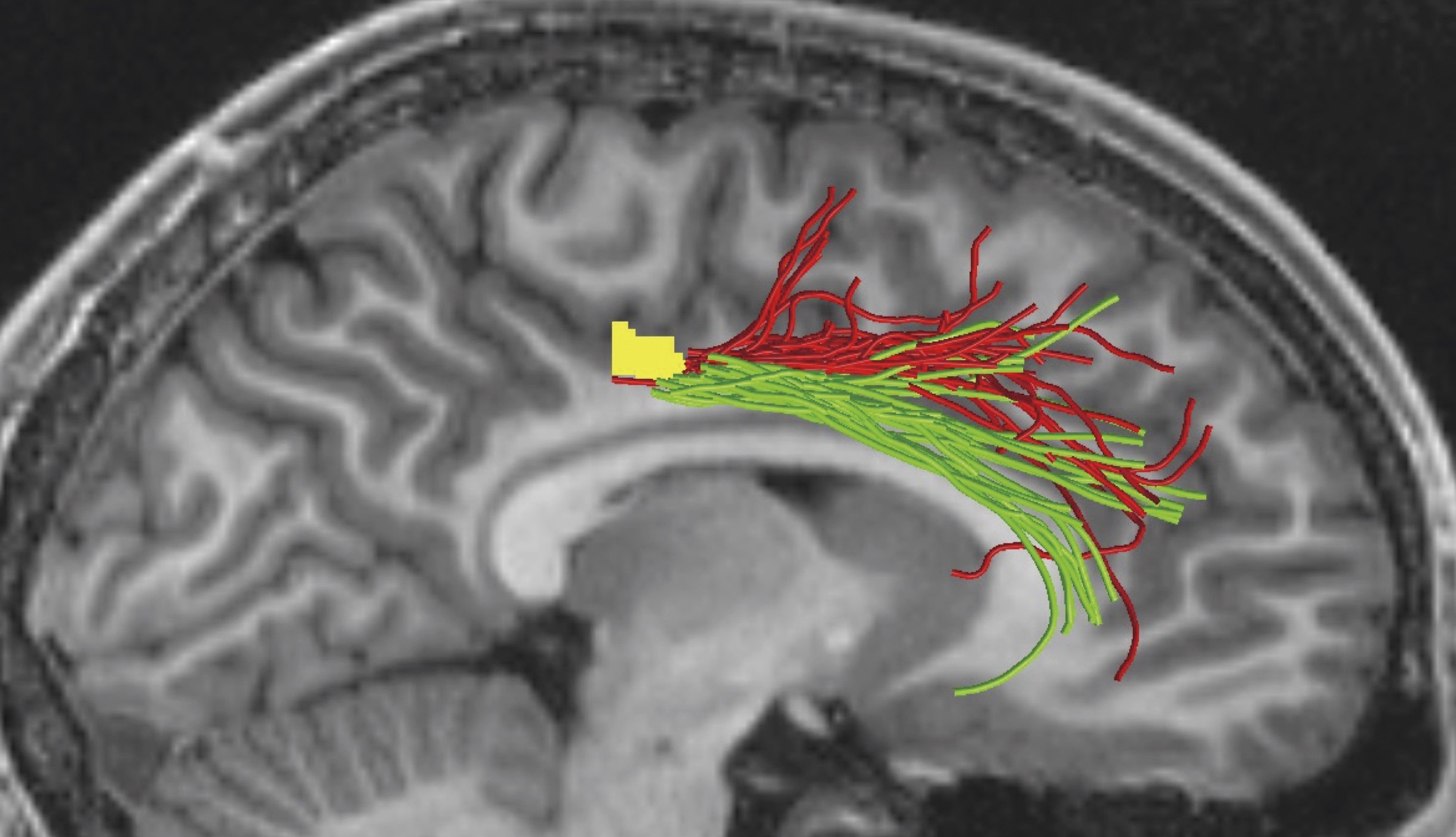 Uesaki et al. (2024) PLoS ONE